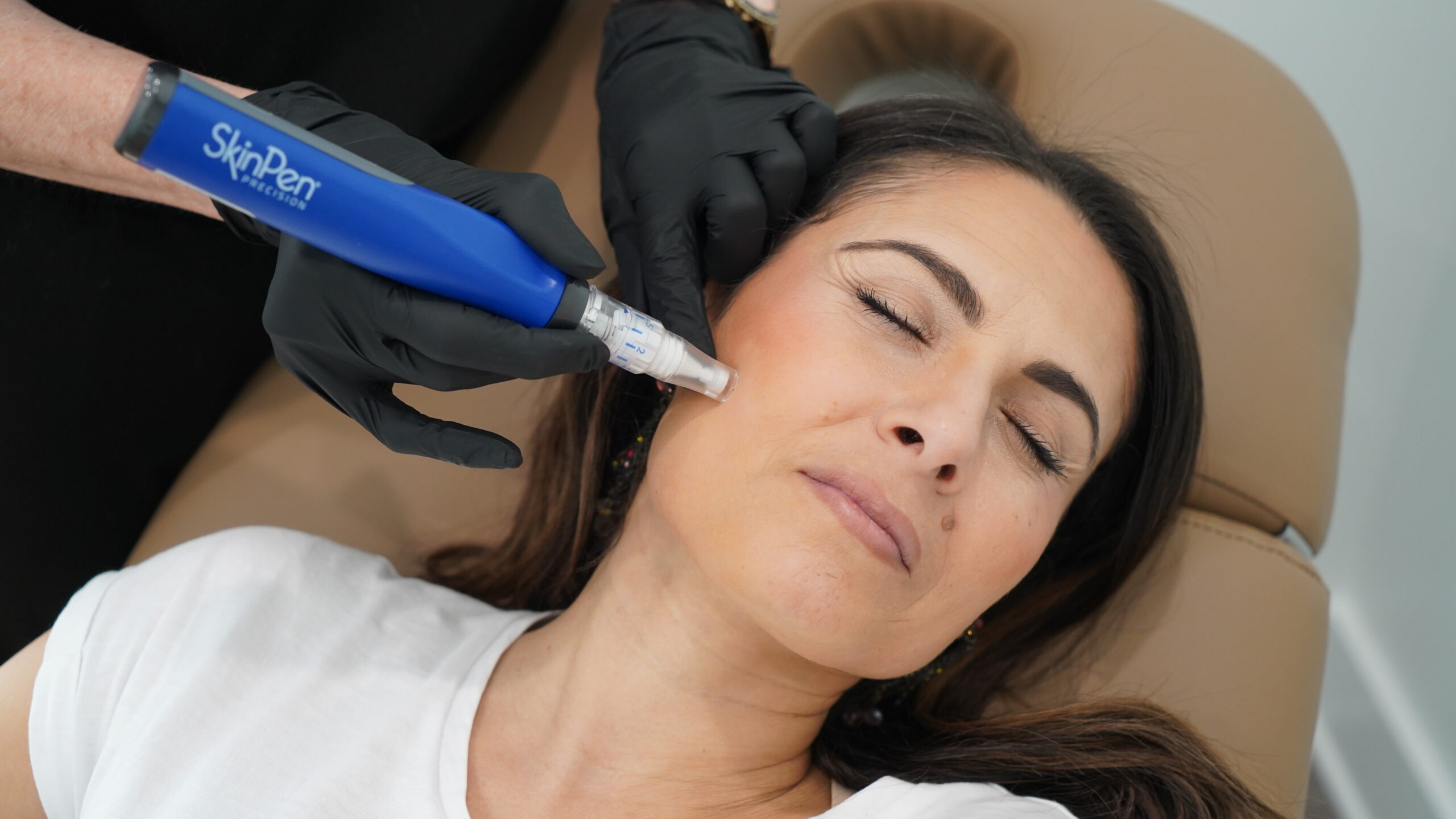 Dermal filler injection in Tampa, Florida for facial rejuvenation